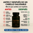 CapilVita – Suplemento Anticaída 💊 | Fortalece y Estimula el Crecimiento del Cabello 🌱 (30 cápsulas)